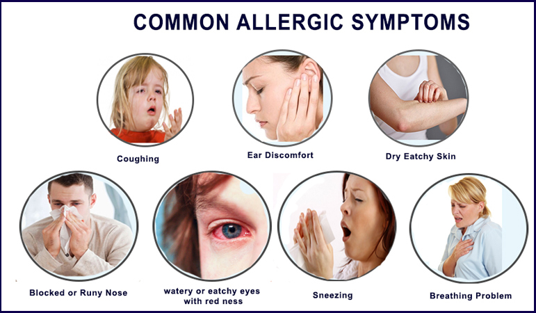 common allergic symtoms